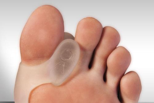 How To Select The Best Bunion Pads 