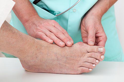 Bunion in a Hospital Doctor examines it