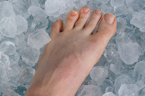 Place your feet into ice